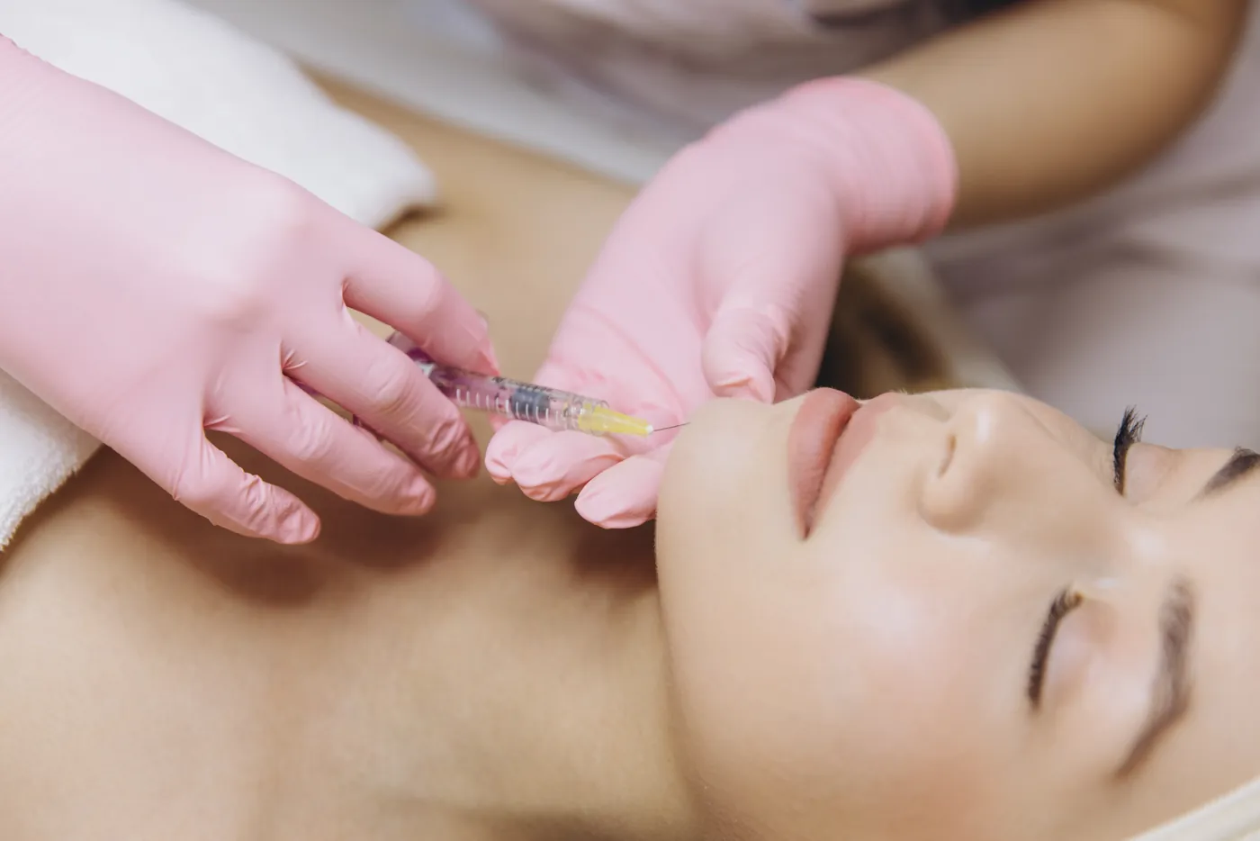 Biostimulator being applied to a patient's chin
